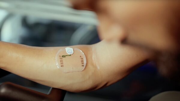 HydroSense AI Sweat Sensor